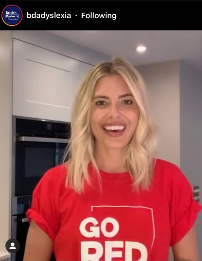 Mollie-King-BDA-Ambassador-UK-768x991